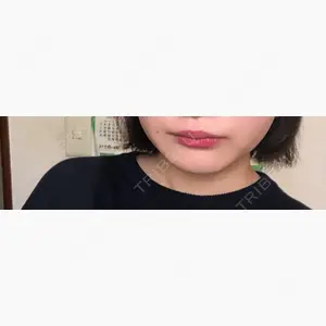 湘南美容クリニック 大宮院口コミ