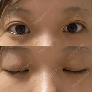 東京イセアクリニック口コミ