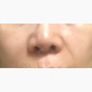 ビューティースキンクリニック 新宿院口コミ