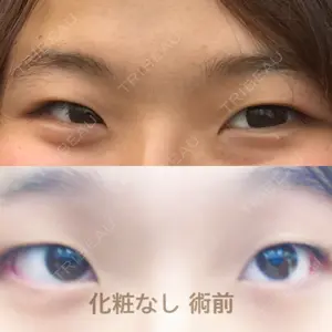 共立美容外科 新宿本院口コミ