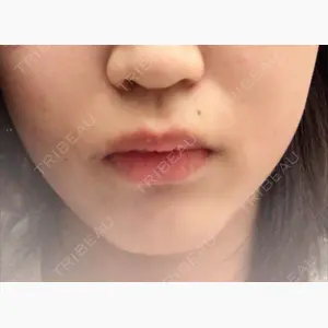 品川美容外科 名古屋院口コミ