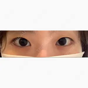 烏丸御池ビューティークリニック口コミ