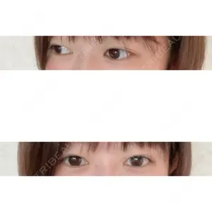 品川美容外科 名古屋院口コミ