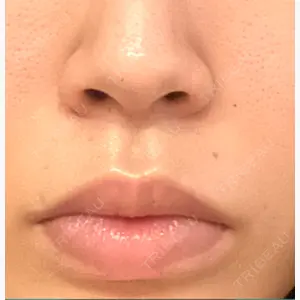 ナチュレ美容クリニック口コミ