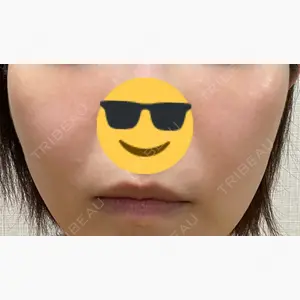 PICO BEAUTY CLINIC口コミ