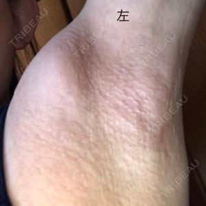湘南美容クリニック 奈良院口コミ