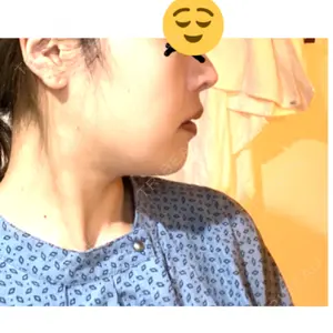 リッツ美容外科 東京院口コミ