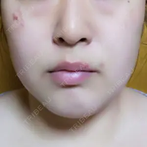 なな歯科クリニック口コミ