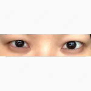 ツツイ美容外科口コミ