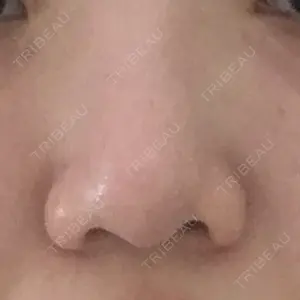 シエルクリニック口コミ