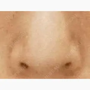 ヴェリテクリニック 銀座院口コミ