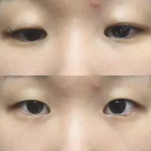 共立美容外科 新宿本院口コミ