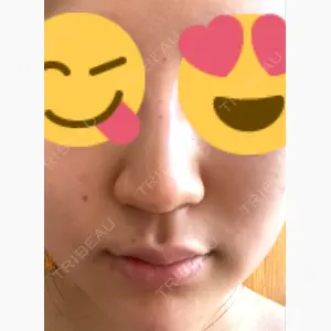 リオラビューティークリニック 上野院口コミ