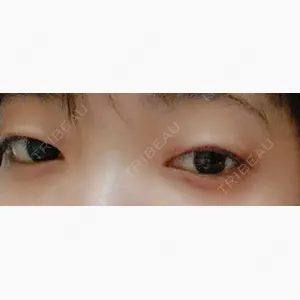 湘南美容クリニック 橋本院口コミ