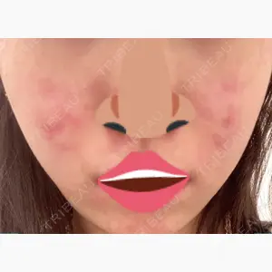 品川美容外科 新宿院（※品川スキンクリニック提携）口コミ