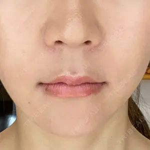 湘南美容クリニック 新宿本院口コミ