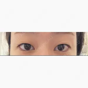 大阪雅美容外科口コミ
