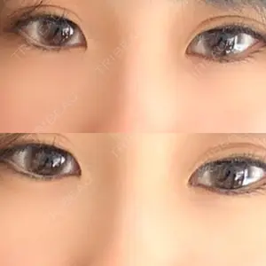 銀座フェイスクリニック（小顔整形・輪郭整形專門）口コミ