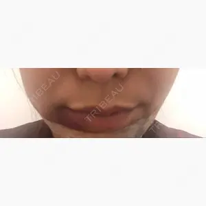 グリム整形外科口コミ