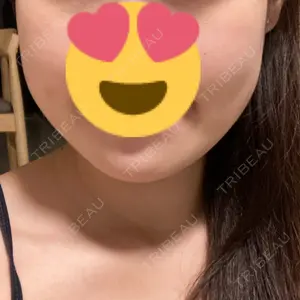 湘南美容クリニック 武蔵小杉院口コミ