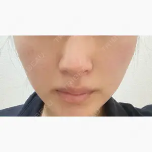 JMスマイルクリニック口コミ