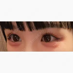 共立美容外科 神戸三宮院口コミ