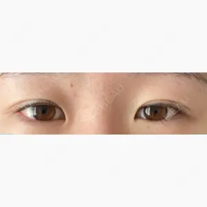 蘇春堂形成外科口コミ