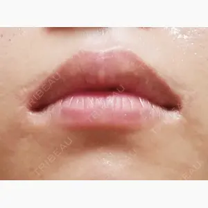 聖心美容クリニック 大阪院口コミ