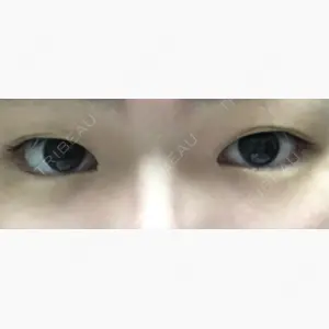 BIANCA銀座口コミ