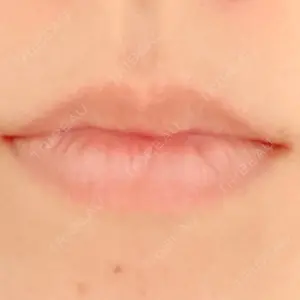 ルラ美容クリニック 新宿院口コミ