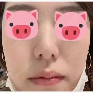 BIANCA銀座口コミ
