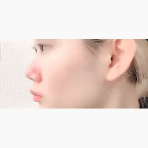 赤坂プレミアクリニック口コミ