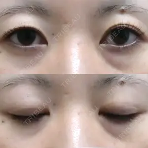 湘南美容クリニック 赤羽院口コミ