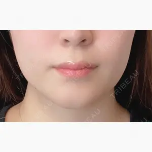 BIANCA銀座口コミ