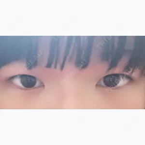 三鷹はなふさ皮膚科口コミ