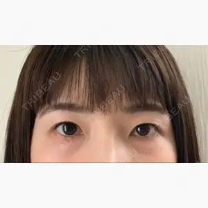 蘇春堂形成外科口コミ