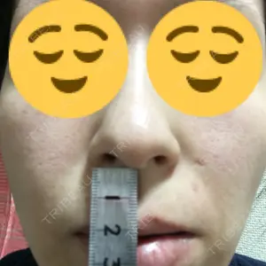 池田クリニック 大阪院口コミ