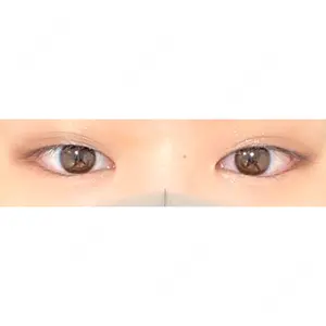 共立美容外科 新宿本院口コミ