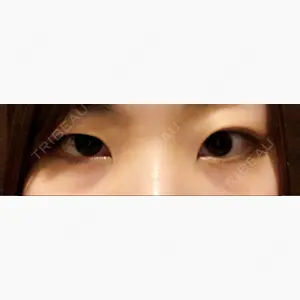 赤坂クリニック口コミ
