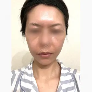 牧野美容クリニック口コミ