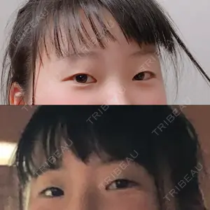 けやき美容クリニック 沼津院口コミ