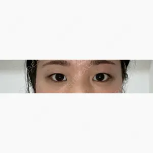 大阪雅美容外科口コミ