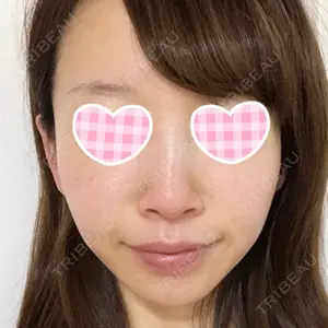 FROM B整形外科 (旧バウム整形外科)口コミ