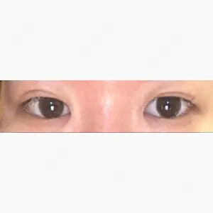 みやび形成外科口コミ