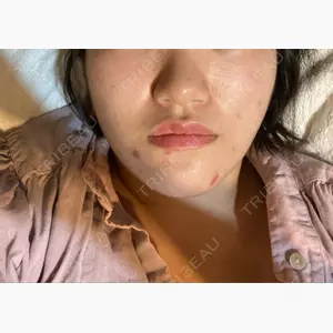 あつぎ美容クリニック口コミ