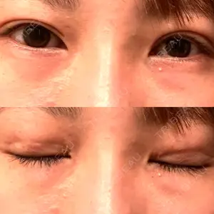 こまちクリニック口コミ