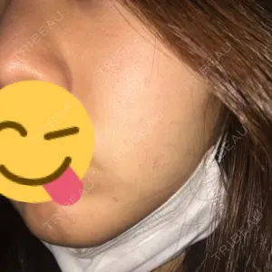BIANCA銀座口コミ