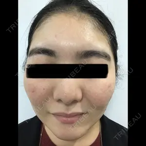 北青山三丁目お肌クリニック口コミ