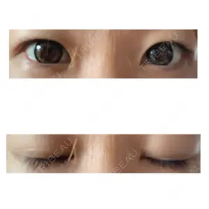 聖心美容クリニック 大阪院口コミ