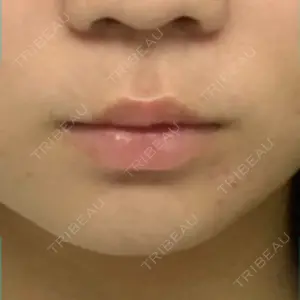 ドクターゴールドマンクリニック 大阪院口コミ